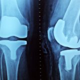 Wir suchen Verstärung im Orthopädiezentrum Neu-Ulm