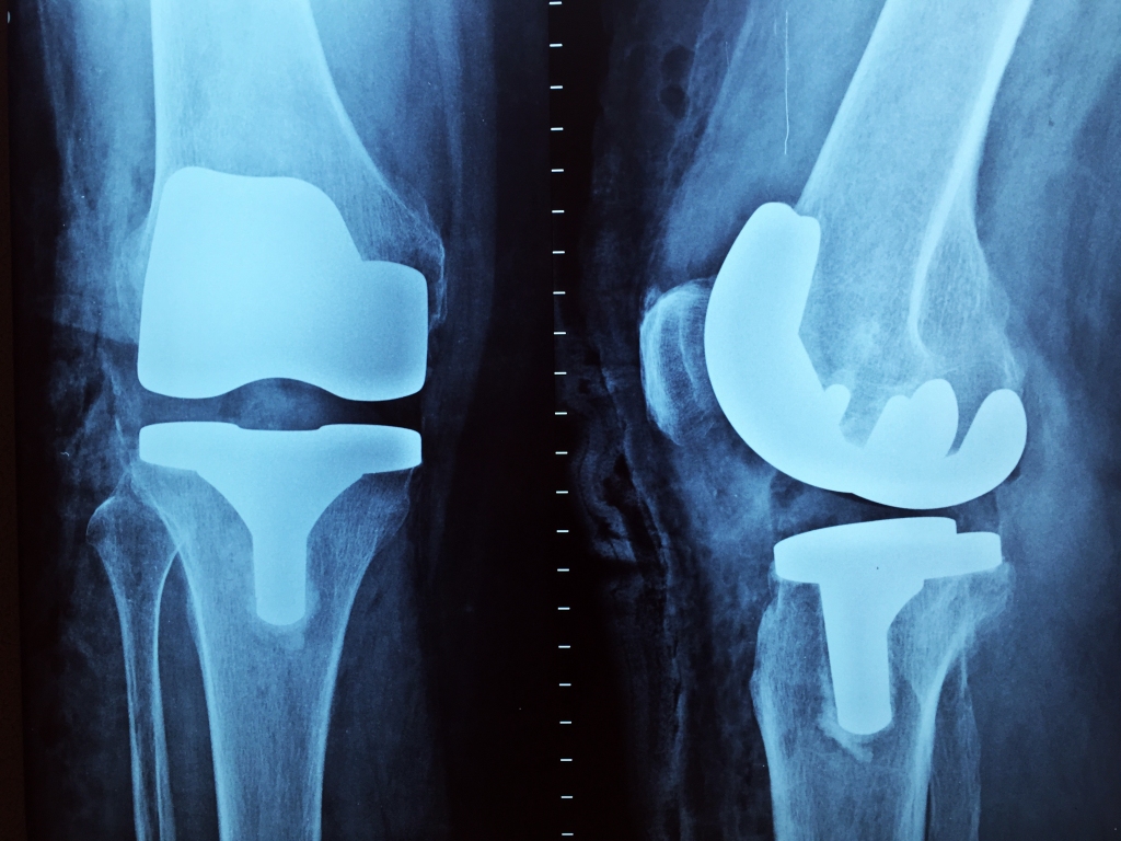 knees_small.jpg